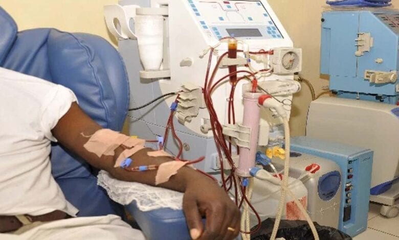 kidney diseases Nigerians