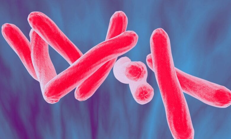 TUBERCULOSIS Sokoto