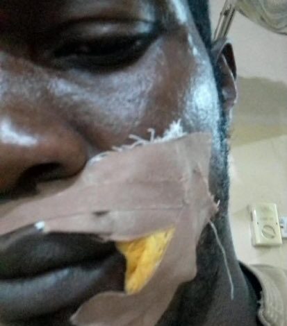 Gunmen attack ADC campaign train in Edo, one shot 1