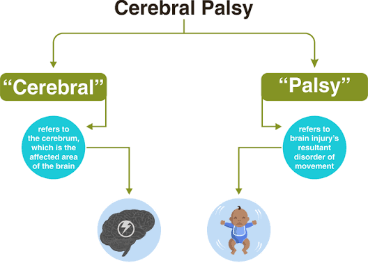 Cerebral Palsy: Building lives without limits 1